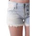 Shorts Stripes e Lace Bray Steve Alan H539